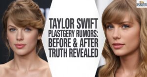 Taylor Swift Plastic Surgery Rumors